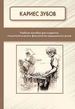 Карієс зубів